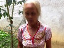 Mâu thuẫn đất đai, người phụ nữ tố bị 2 thanh niên nhét chất thải bẩn vào miệng Mâu thuẫn đất đai, người phụ nữ tố bị 2 thanh niên nhét chất thải bẩn vào miệng
