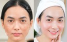Chọn chuẩn, an tâm trẻ hóa da tại Thẩm mỹ viện Linh Anh