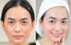 Chọn chuẩn, an tâm trẻ hóa da tại Thẩm mỹ viện Linh Anh