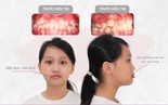 Con móm di truyền từ mẹ: mẹ có thể giúp con "đảo ngược" số phận