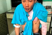 Vụ cha dượng đốt 3 người ở Đồng Nai: Hai cháu bé đã tử vong