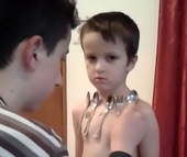 Cậu bé 5 tuổi có khả năng hút kim loại vào người