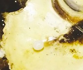 Ăn hàu nướng, cắn trúng ngọc trai