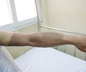 Nổ chùm bóng bay, 4 người nhập viện