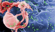 Tái phát HIV sau khi khỏi AIDS