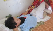 Mẹ lỡ tay làm con ngã vào đống lửa, bị bỏng nặng