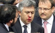 Nghị sĩ Thổ Nhĩ Kỳ vỡ mũi trong phiên họp quốc hội