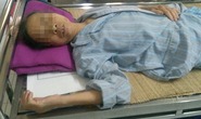 Bị côn trùng đốt có thể tử vong
