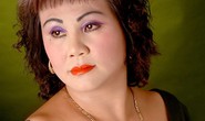 Nghệ sĩ Hoàng Lan nguy cơ mù mắt phải