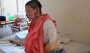 TP HCM: Đang đi, một nữ công nhân bị tạt axit
