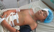 Xe đạp bất ngờ gãy cổ, nam sinh lớp 7 vỡ gan