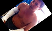 Hai cán bộ tòa án bị 3 kẻ bịt mặt truy sát trong đêm