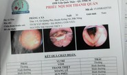 Khạc ra máu do bị đỉa chui vào cuống họng