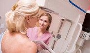 X-quang tuyến vú dự báo nguy cơ bệnh tim mạch