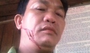 Bị phát hiện chở gỗ lậu, lâm tặc vác dao vào trạm chém kiểm lâm
