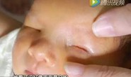 Em bé không mắt” ở Trung Quốc