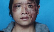 Bị chồng bạo hành vì “chát chít” trên mạng