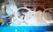 Bé sơ sinh sống lại sau 15 giờ trong nhà xác