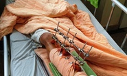 Nam thanh niên bị chém đứt lìa chân ở Gia Lai