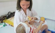 Bé gái 2 tuổi bị lột toàn bộ da đầu vì tai nạn giao thông