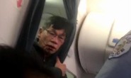 Bác sĩ gốc Việt bắt đầu đưa United Airlines ra tòa