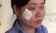 Nam tài xế phun mưa, hành hung nữ nhân viên gác tàu mang thai