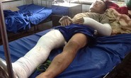 Đòi tiền công gửi về quê sắm Tết, bị ông chủ đánh tàn tật