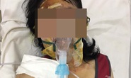 Cô giáo bị bỏng nặng ở Phú Quốc đang dần hồi phục