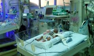 “Hồi sinh” bé gái chỉ nặng 855g khi ra đời