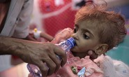 Nạn đói thế kỷ ở Yemen