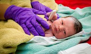 Pháp điều tra nguyên nhân trẻ sơ sinh thiếu tay