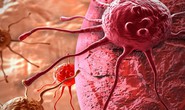 Phát hiện 2 protein ở da người tự hủy tế bào ung thư