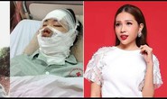Cháy mặt một lần, Khả Như bị lửa ám ảnh