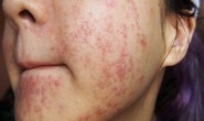 Biết những tác hại này xem chị em nào còn mê “kem trộn”