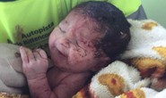 Văng khỏi bụng mẹ trong tai nạn giao thông, em bé sống sót kỳ diệu