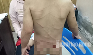 Giải cứu bé trai 3 tuổi bị cha dượng đánh dã man ở Phú Quốc