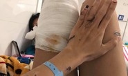 Cựu thiếu úy công an tạt axit vợ sắp cưới vì ghen tuông bị tăng thêm 2 năm tù