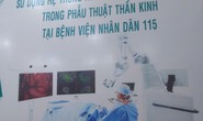 Bệnh viện Nhân dân 115  mổ não miễn phí bằng robot