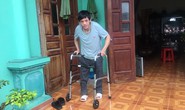 Hát trên bàn mổ và nắn thẳng chân ếch