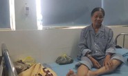 Điều tra vụ Phó chủ tịch UBND phường bị tố hành hung gẫy chân 1 phụ nữ