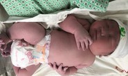 Vừa lọt lòng, bé trai đã có cân nặng ngang trẻ 3 tháng