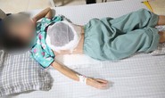 Người phụ nữ bị ngực lở loét, hoại tử do thầy lang bảo cứ chờ khối u vỡ