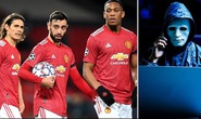 Man United khốc hại vì hacker