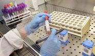 Việt Nam nghiên cứu, thử nghiệm thuốc điều trị virus corona mới trong vòng 4 tuần
