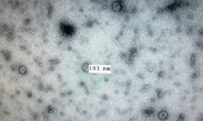 Việt Nam nuôi cấy và phân lập thành công virus nCoV