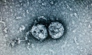 Phát hiện chủng virus SARS-CoV-2 gây dịch Covid-19 tại VN có thay đổi