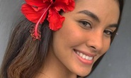 Phát hiện thi thể người mẫu Brazil ở nhà bạn trai