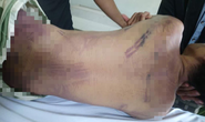 Khởi tố kẻ đánh chết phạm nhân trong nhà tạm giữ