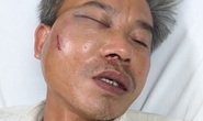 Nhân viên cây xanh bị đánh vì chụp hình băng rôn