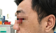 Lưỡi cưa cắt gạch bị gãy, đâm thẳng vào mắt người đàn ông nghèo